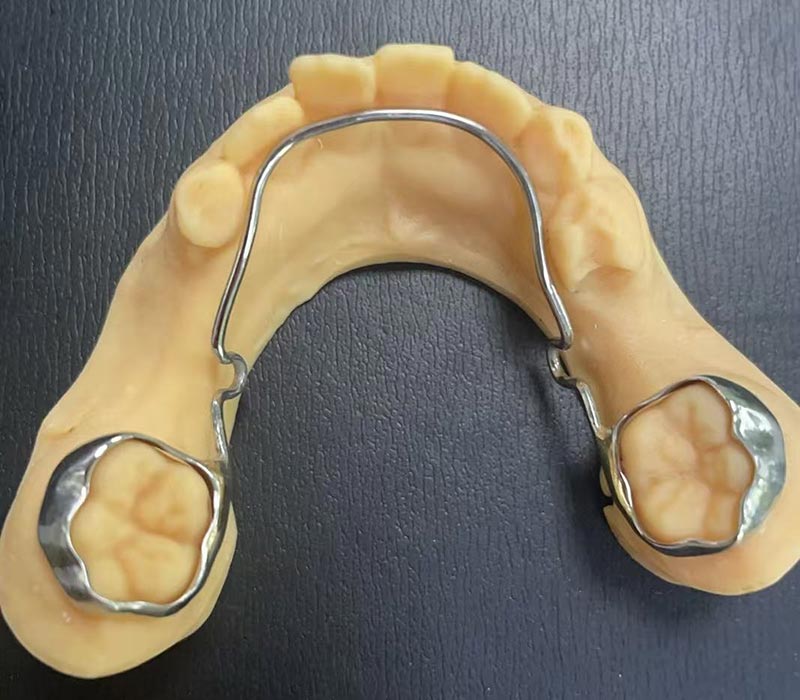 Mandibular Lingual Ark Tutucu