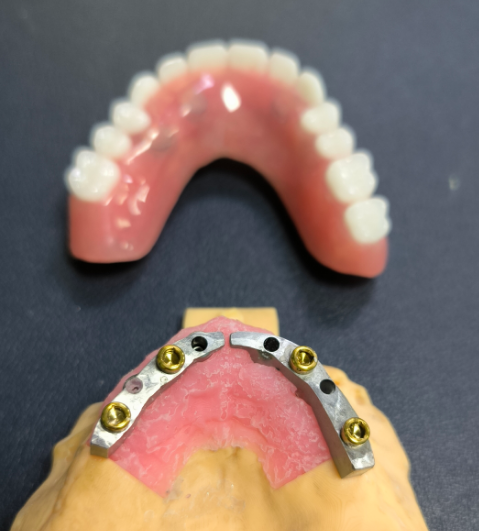 Konum Belirleyici ve Titanyum Dental Bar