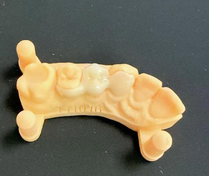 Maryland Köprüleri Hakkında Bilmeniz Gerekenler?