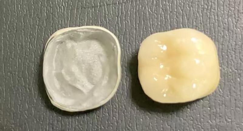 WM DENTAL LAB – Çin'in Öncü Diş Laboratuvarı