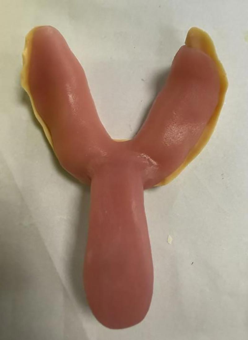 Özel Diş Kaşıkları Hakkında Bilmediğiniz Şeyler