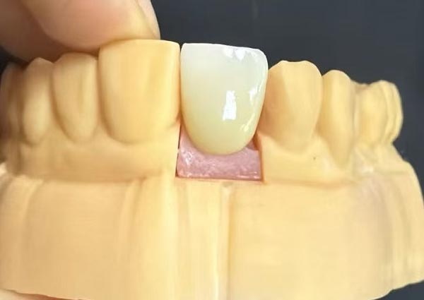 Dişler Arasındaki Boşluklar Düzeltilebilir; Düz Dişler En Çekici Olanlardır!